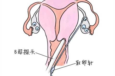 http://zhengzhou.vdtfzz.com/post/205.html|郑州供卵助孕