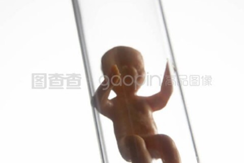 http://zhengzhou.vdtfzz.com/post/197.html|郑州试管助孕